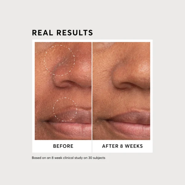 Naturium Niacinamide Serum 12% Plus Zinc 2% - Image 4