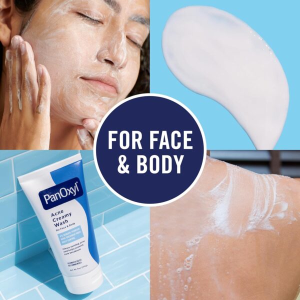 PanOxyl Acne Creamy Wash 4% Benzoyl Peroxide - Image 2